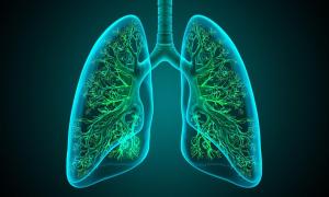 AlveoSafe: Precision Monitoring Method to Prevent Ventilator Injury 