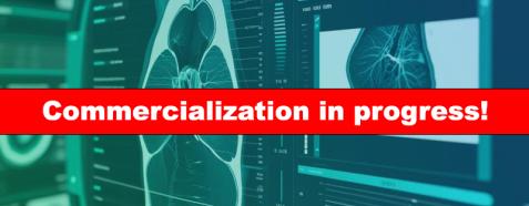 smart prostate